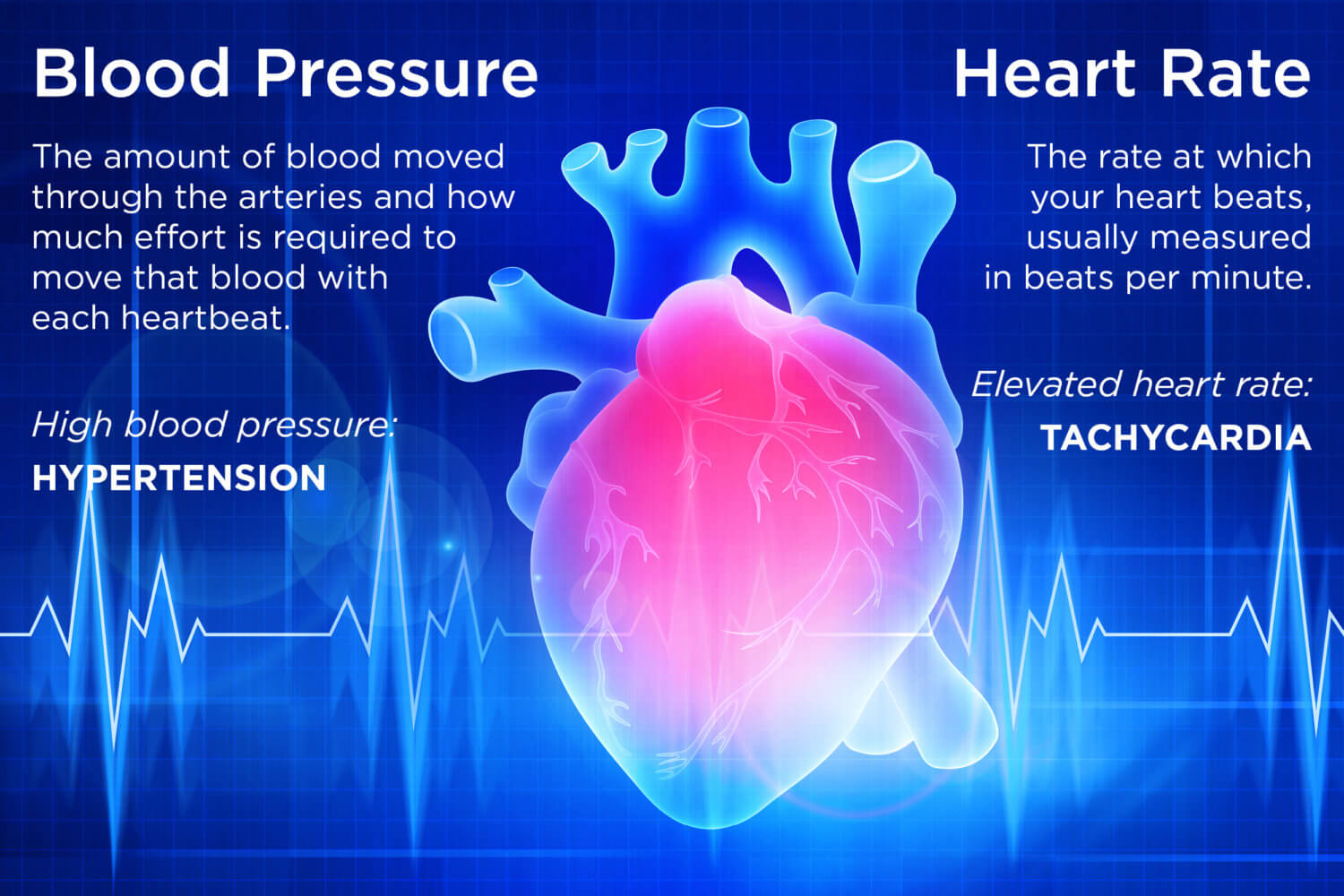 Descriptions de la pression artérielle et de la fréquence cardiaque sur une image radiographique colorée d'un cœur avec des lignes ECG derrière