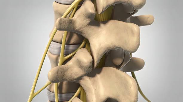 La pression sur les racines nerveuses causée par la moelle épinière et la dégénérescence peuvent être causées par ce qui suit.  Disques glissés ou herniés.